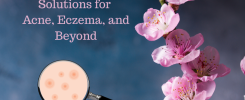 Holistic Solutions for Acne